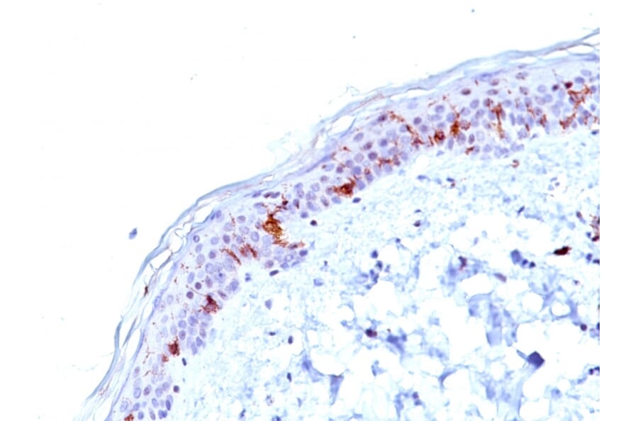 Immunohistochemistry - Anti-CD1a Antibody [O10] - BSA and Azide free (A253647) - Antibodies.com