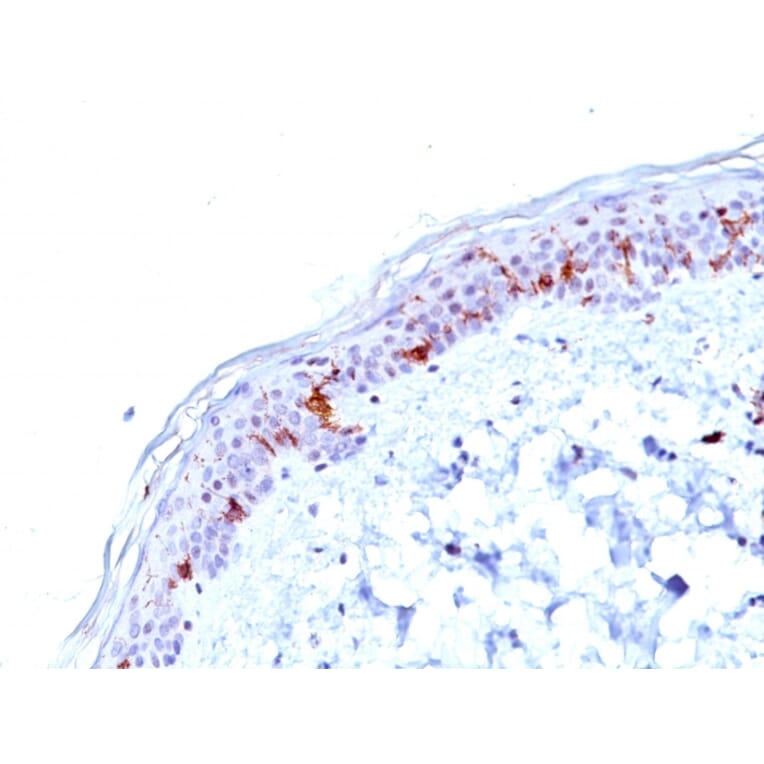 Immunohistochemistry - Anti-CD1a Antibody [O10] - BSA and Azide free (A253647) - Antibodies.com