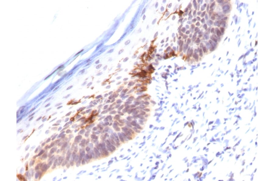 Immunohistochemistry - Anti-CD1a Antibody [SPM120] - BSA and Azide free (A253648) - Antibodies.com