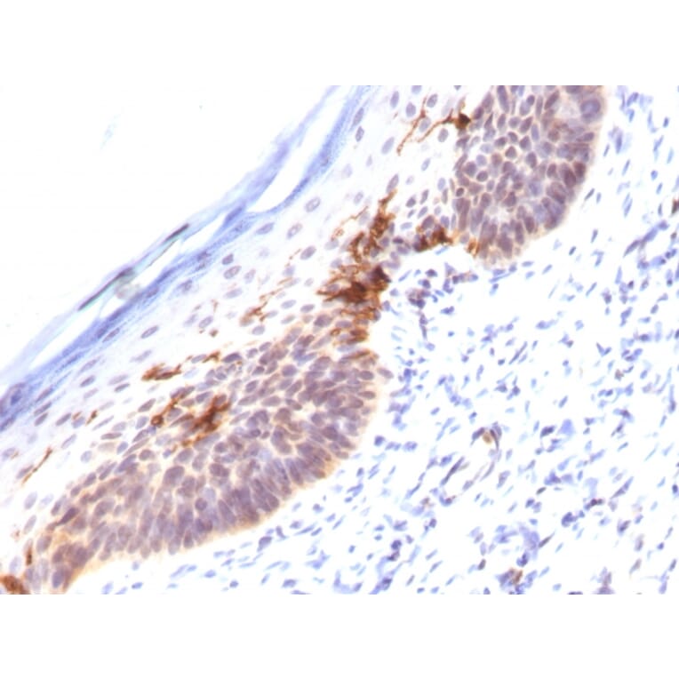 Immunohistochemistry - Anti-CD1a Antibody [SPM120] - BSA and Azide free (A253648) - Antibodies.com