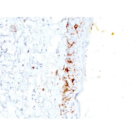 Immunohistochemistry - Anti-CD1a Antibody [C1A/711] - BSA and Azide free (A253649) - Antibodies.com