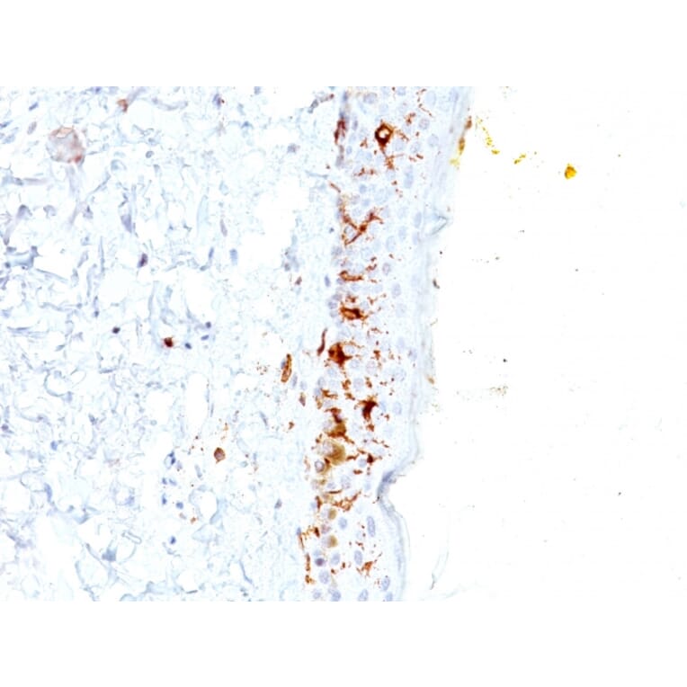 Immunohistochemistry - Anti-CD1a Antibody [C1A/711] - BSA and Azide free (A253649) - Antibodies.com