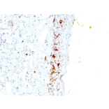 Immunohistochemistry - Anti-CD1a Antibody [C1A/711] - BSA and Azide free (A253649) - Antibodies.com