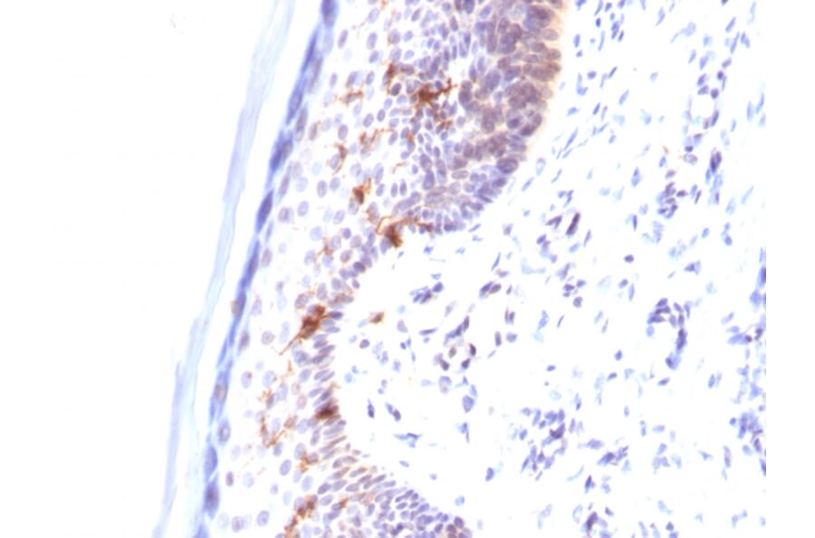 Immunohistochemistry - Anti-CD1a Antibody [C1A/711] - BSA and Azide free (A253648) - Antibodies.com