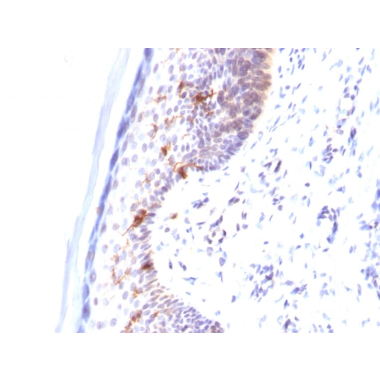 Immunohistochemistry - Anti-CD1a Antibody [C1A/711] - BSA and Azide free (A253648) - Antibodies.com