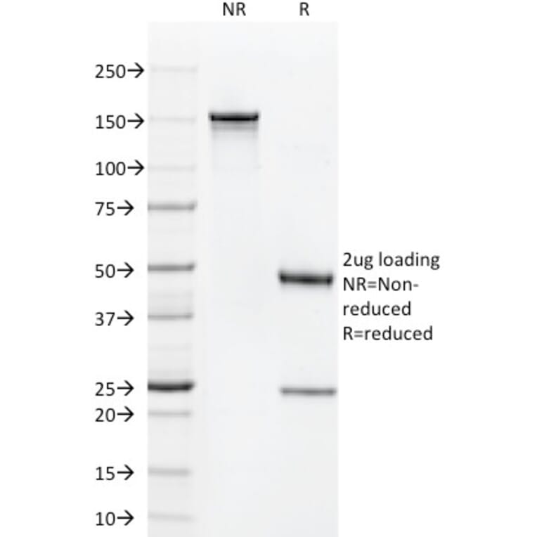 SDS-PAGE - Anti-CD1a Antibody [C1A/711] - BSA and Azide free (A253649) - Antibodies.com