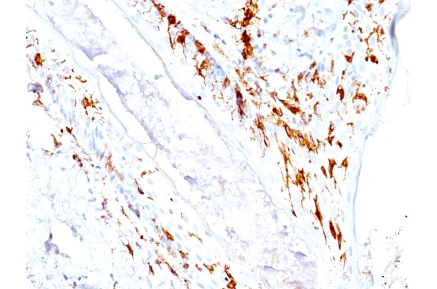 Immunohistochemistry - Anti-CD1a Antibody [O10+C1A/711] - BSA and Azide free (A253649) - Antibodies.com