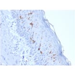 Immunohistochemistry - Anti-CD1a Antibody [rC1A/711] - BSA and Azide free (A253653) - Antibodies.com