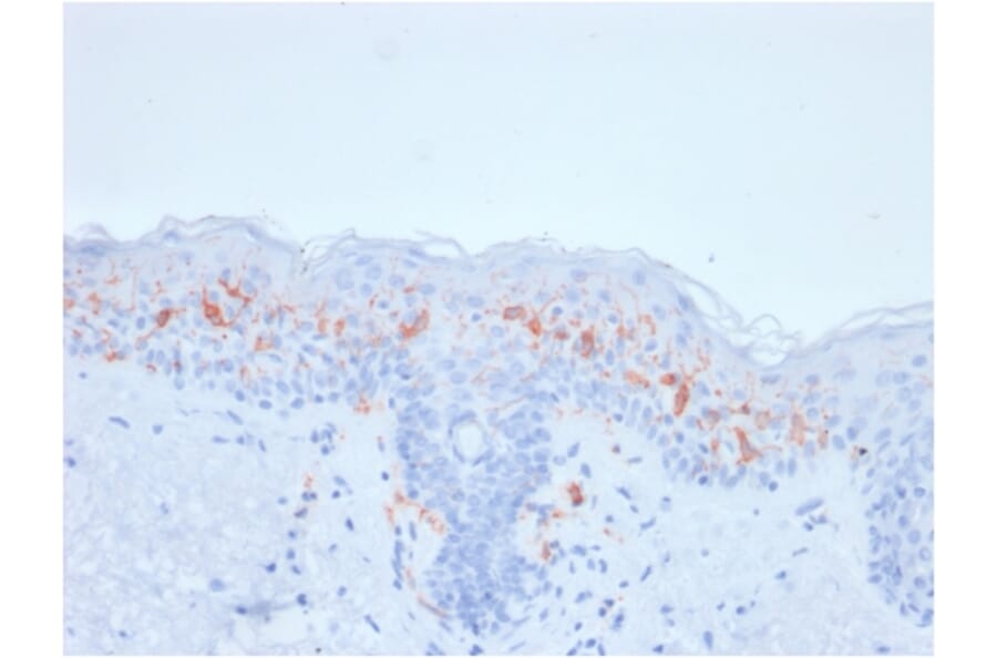Immunohistochemistry - Anti-CD1a Antibody [rC1A/711] - BSA and Azide free (A253653) - Antibodies.com