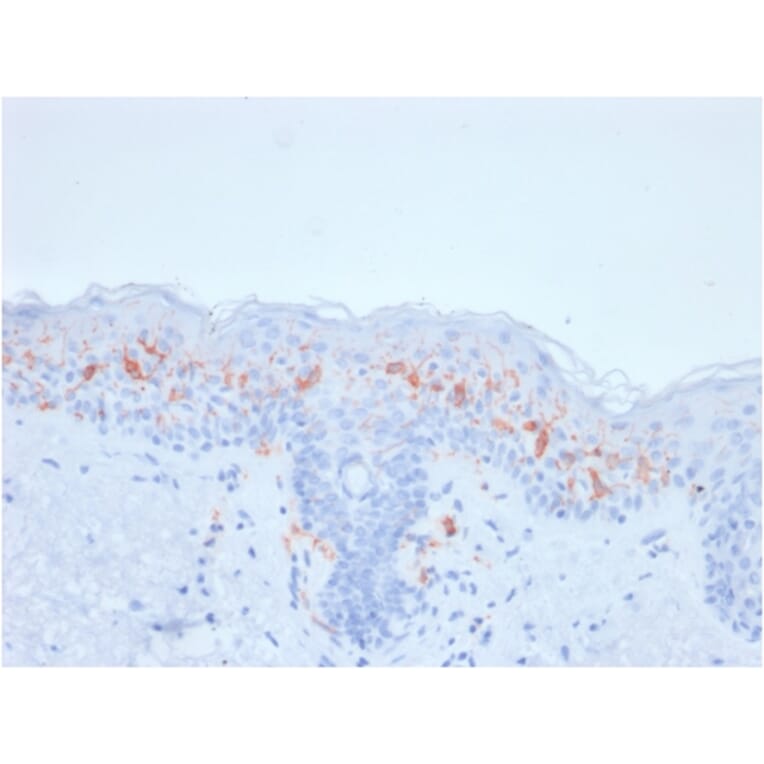 Immunohistochemistry - Anti-CD1a Antibody [rC1A/711] - BSA and Azide free (A253653) - Antibodies.com