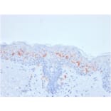 Immunohistochemistry - Anti-CD1a Antibody [rC1A/711] - BSA and Azide free (A253653) - Antibodies.com