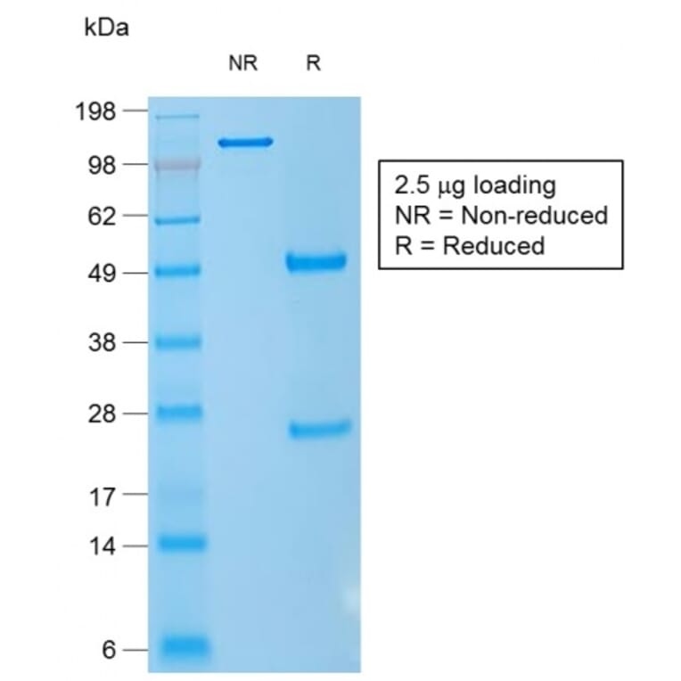 SDS-PAGE - Anti-CD1a Antibody [rC1A/711] - BSA and Azide free (A253653) - Antibodies.com
