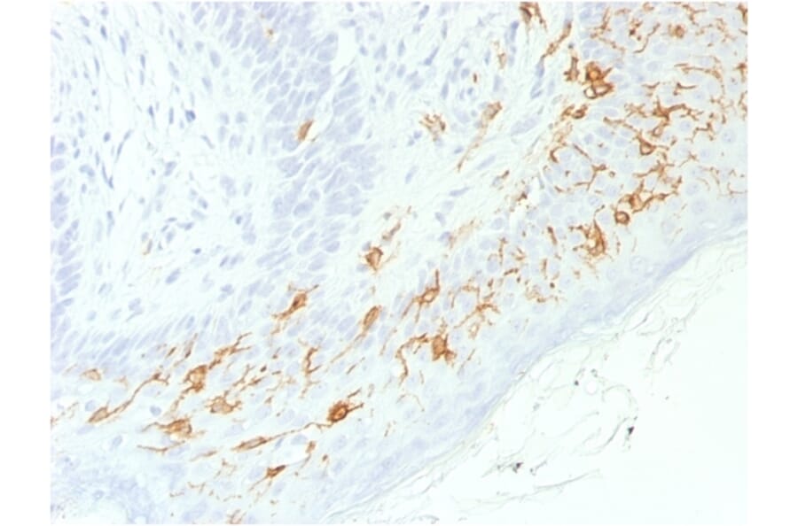 Immunohistochemistry - Anti-CD1a Antibody [C1A/1506R] - BSA and Azide free (A253655) - Antibodies.com
