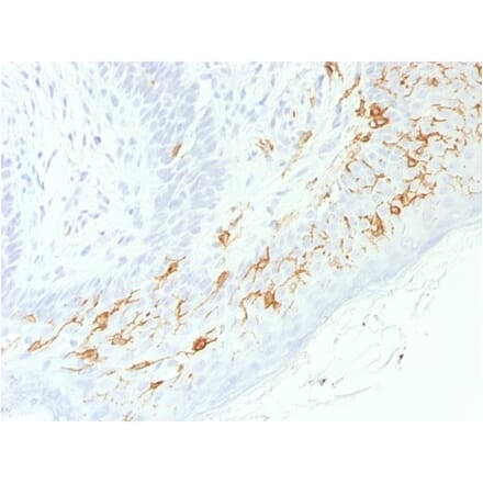 Immunohistochemistry - Anti-CD1a Antibody [C1A/1506R] - BSA and Azide free (A253655) - Antibodies.com