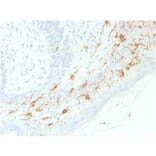 Immunohistochemistry - Anti-CD1a Antibody [C1A/1506R] - BSA and Azide free (A253655) - Antibodies.com