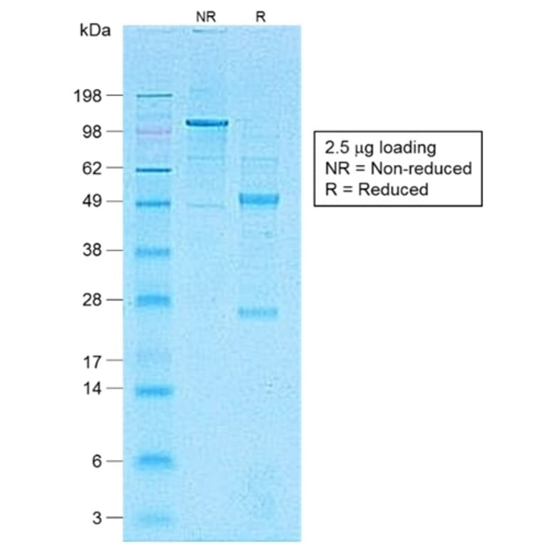 SDS-PAGE - Anti-CD1a Antibody [C1A/1506R] - BSA and Azide free (A253655) - Antibodies.com