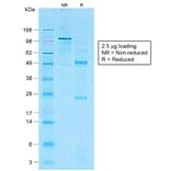 SDS-PAGE - Anti-CD1a Antibody [C1A/1506R] - BSA and Azide free (A253655) - Antibodies.com