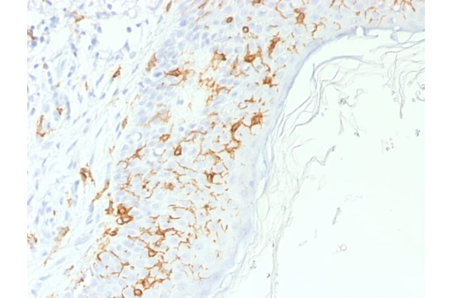 Immunohistochemistry - Anti-CD1a Antibody - BSA and Azide free (A253655) - Antibodies.com