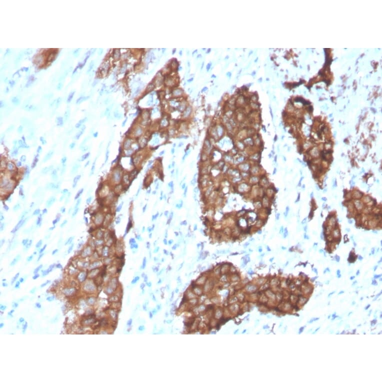 Immunohistochemistry - Anti-PDLIM1 Antibody [CPTC-PDLIM1-1] - BSA and Azide free (A253659) - Antibodies.com