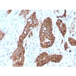 Immunohistochemistry - Anti-PDLIM1 Antibody [CPTC-PDLIM1-1] - BSA and Azide free (A253659) - Antibodies.com