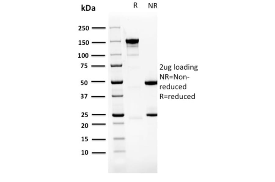 SDS-PAGE - Anti-PDLIM1 Antibody [CPTC-PDLIM1-1] - BSA and Azide free (A253660) - Antibodies.com