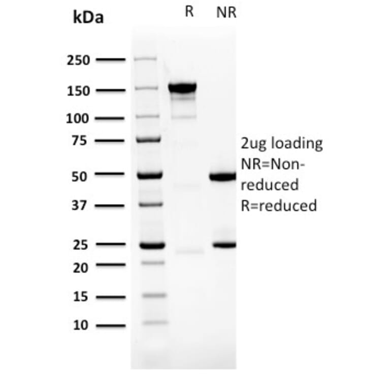 SDS-PAGE - Anti-PDLIM1 Antibody [CPTC-PDLIM1-1] - BSA and Azide free (A253660) - Antibodies.com