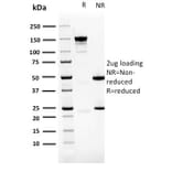SDS-PAGE - Anti-PDLIM1 Antibody [CPTC-PDLIM1-1] - BSA and Azide free (A253660) - Antibodies.com