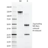 SDS-PAGE - Anti-CD2 Antibody [1E7E8.G4] - BSA and Azide free (A253662) - Antibodies.com