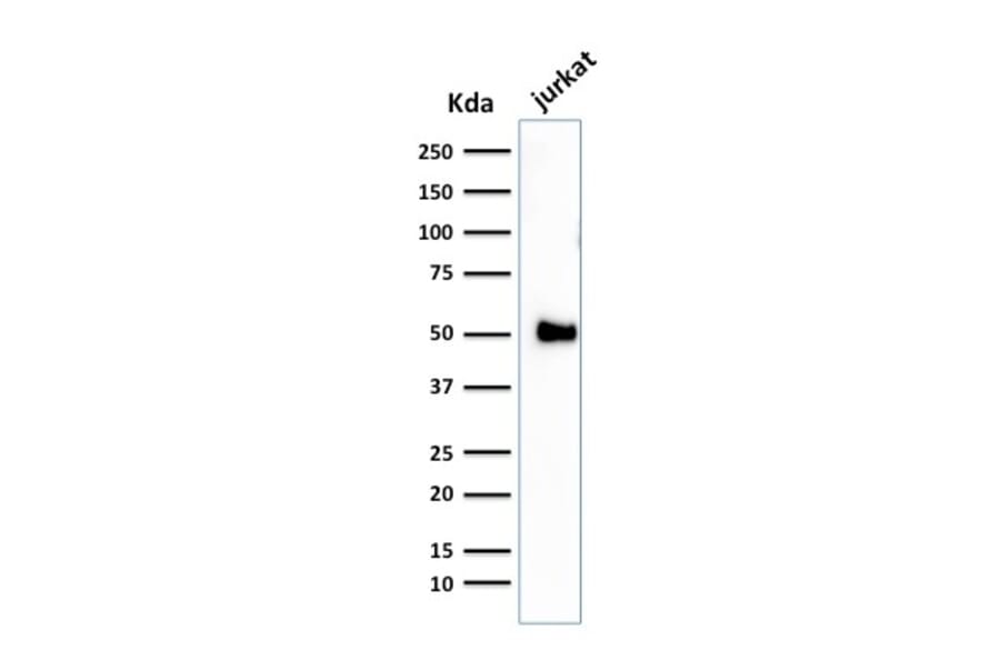 Western Blot - Anti-CD2 Antibody [1E7E8.G4] - BSA and Azide free (A253662) - Antibodies.com
