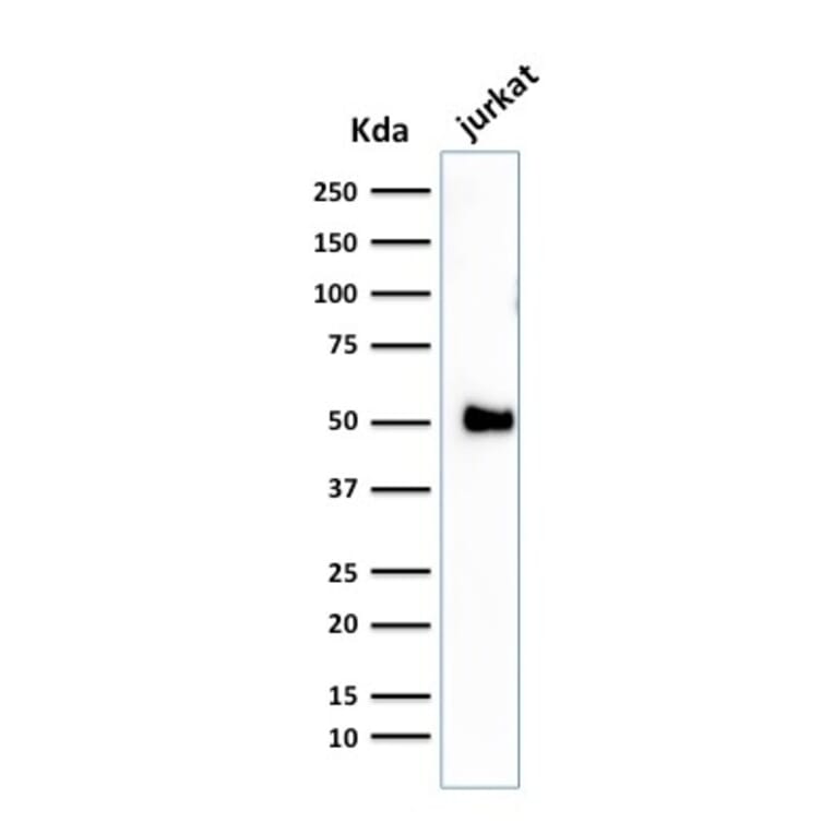 Western Blot - Anti-CD2 Antibody [1E7E8.G4] - BSA and Azide free (A253662) - Antibodies.com