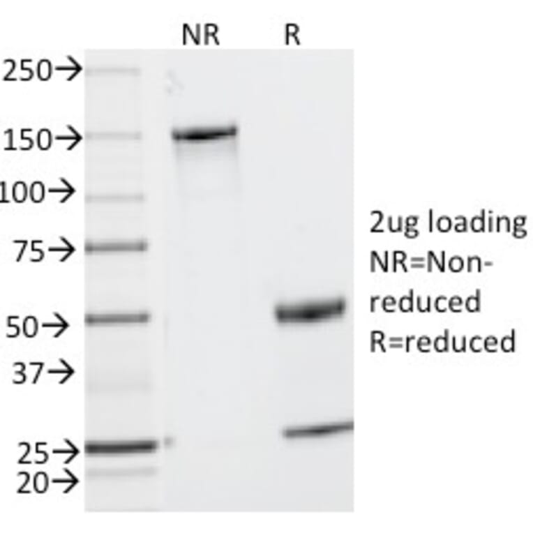 SDS-PAGE - Anti-CD2 Antibody [UMCD2] - BSA and Azide free (A253663) - Antibodies.com
