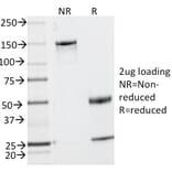SDS-PAGE - Anti-CD2 Antibody [UMCD2] - BSA and Azide free (A253663) - Antibodies.com