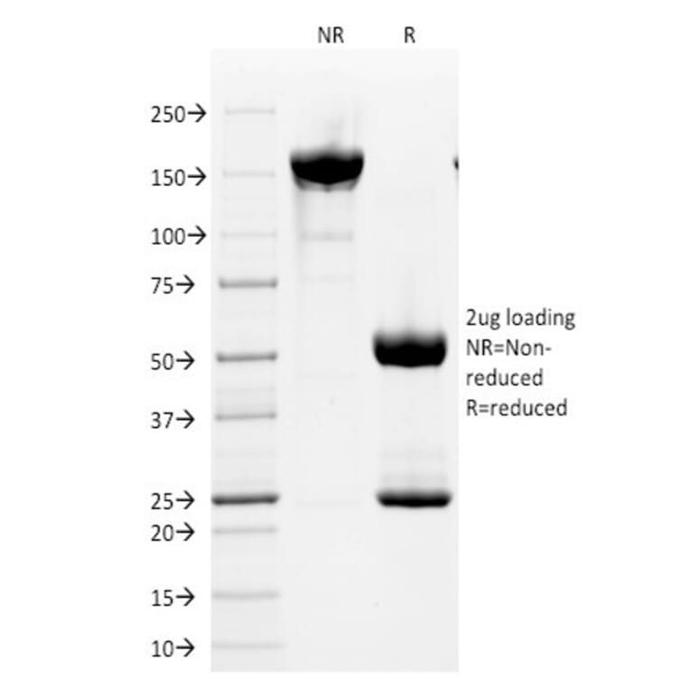 SDS-PAGE - Anti-CD2 Antibody [HuLy-m1] - BSA and Azide free (A253665) - Antibodies.com