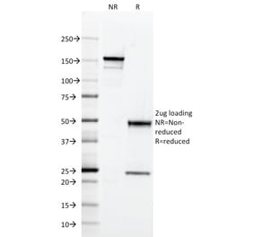 SDS-PAGE - Anti-CD2 Antibody [RPA-2.10] - BSA and Azide free (A253665) - Antibodies.com