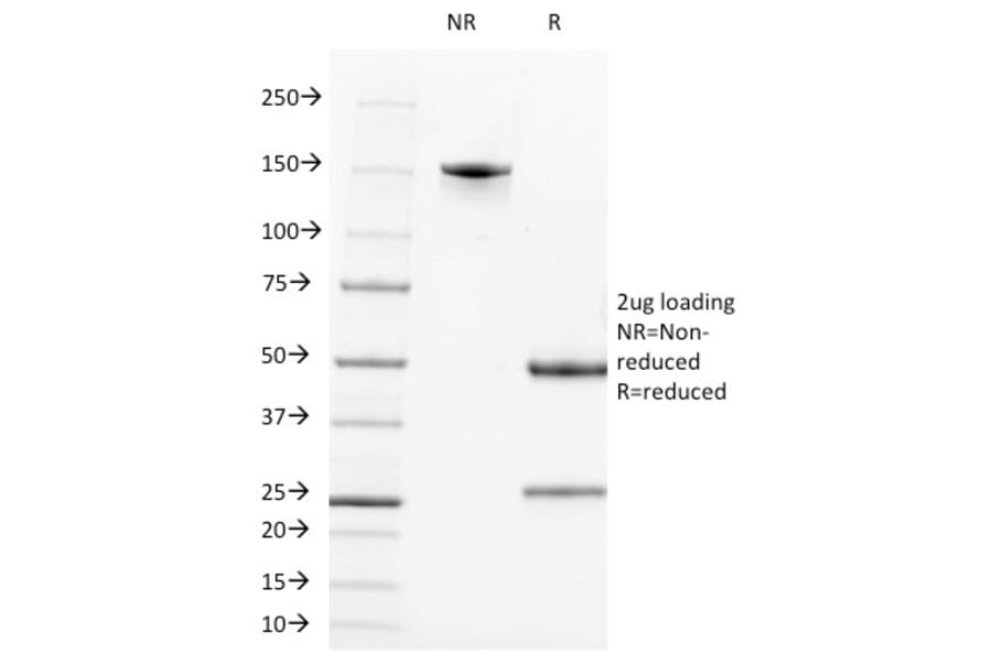 SDS-PAGE - Anti-CD2 Antibody [LFA2/600] - BSA and Azide free (A253667) - Antibodies.com