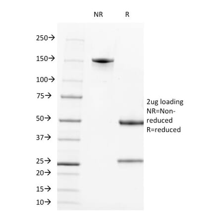 SDS-PAGE - Anti-CD2 Antibody [LFA2/600] - BSA and Azide free (A253667) - Antibodies.com