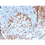 Immunohistochemistry - Anti-CD2 Antibody [LFA2/3417R] - BSA and Azide free (A253668) - Antibodies.com