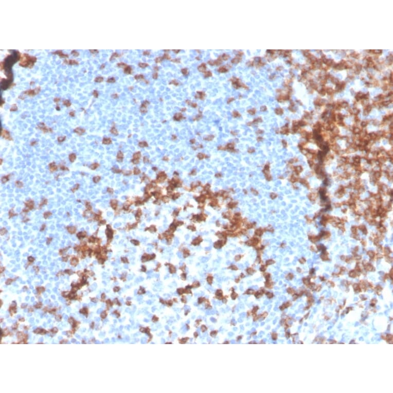 Immunohistochemistry - Anti-CD2 Antibody [LFA2/3417R] - BSA and Azide free (A253667) - Antibodies.com