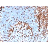 Immunohistochemistry - Anti-CD2 Antibody [LFA2/3417R] - BSA and Azide free (A253667) - Antibodies.com
