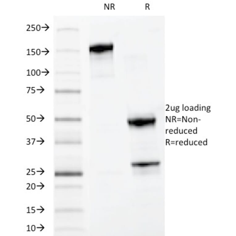 SDS-PAGE - Anti-MYADM Antibody [MYADM/972] - BSA and Azide free (A253670) - Antibodies.com