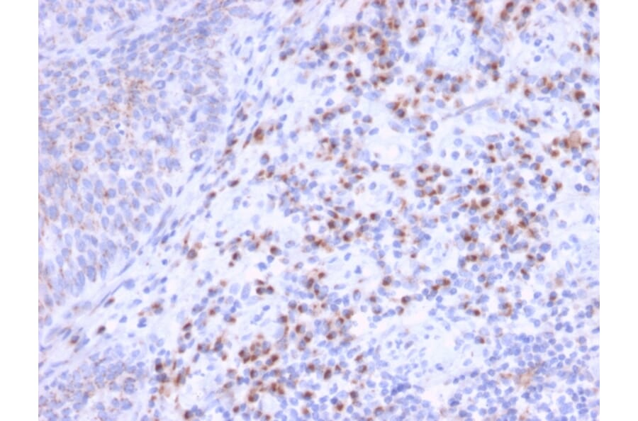 Immunohistochemistry - Anti-RCAS1 Antibody [CPTC-EBAG9-1] - BSA and Azide free (A253671) - Antibodies.com