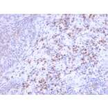 Immunohistochemistry - Anti-RCAS1 Antibody [CPTC-EBAG9-1] - BSA and Azide free (A253671) - Antibodies.com