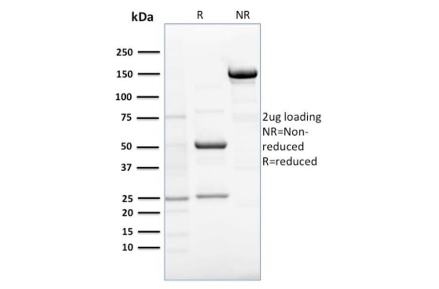 SDS-PAGE - Anti-RCAS1 Antibody [CPTC-EBAG9-1] - BSA and Azide free (A253671) - Antibodies.com