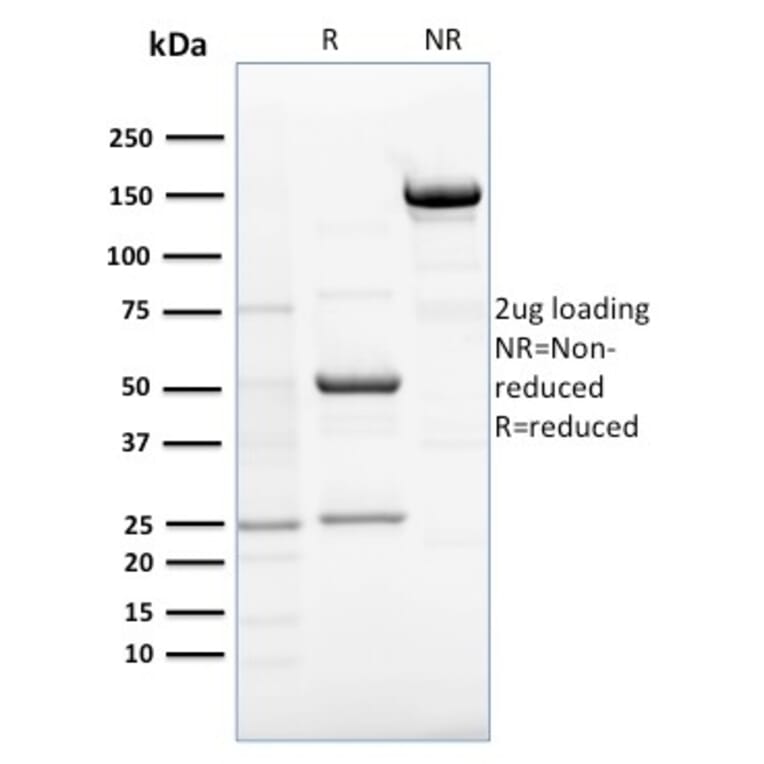 SDS-PAGE - Anti-RCAS1 Antibody [CPTC-EBAG9-1] - BSA and Azide free (A253671) - Antibodies.com