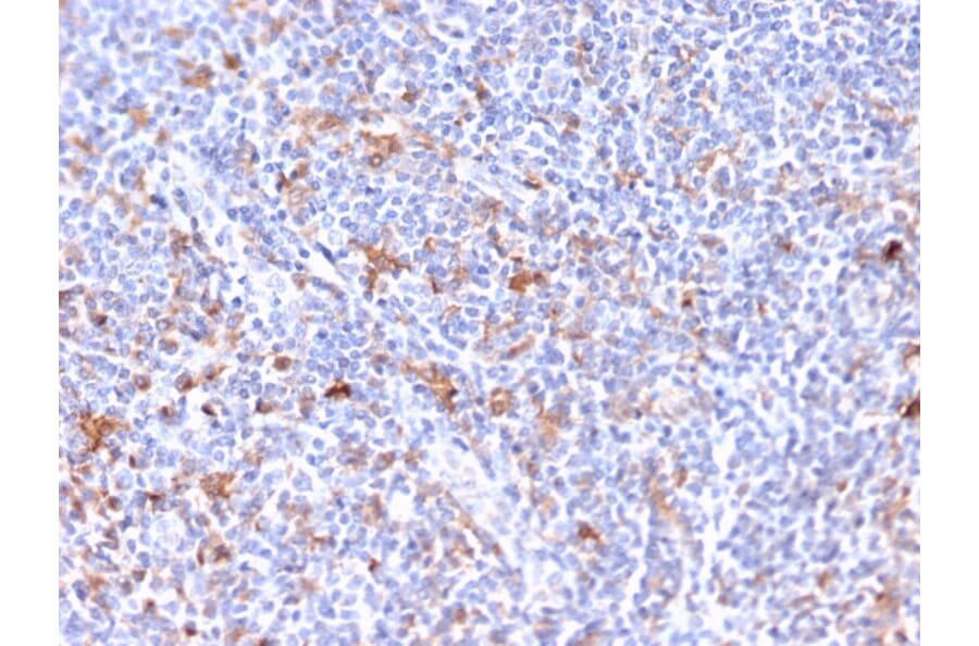 Immunohistochemistry - Anti-RCAS1 Antibody [CPTC-EBAG9-2] - BSA and Azide free (A253671) - Antibodies.com