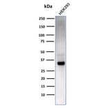 Western Blot - Anti-RCAS1 Antibody [CPTC-EBAG9-2] - BSA and Azide free (A253672) - Antibodies.com