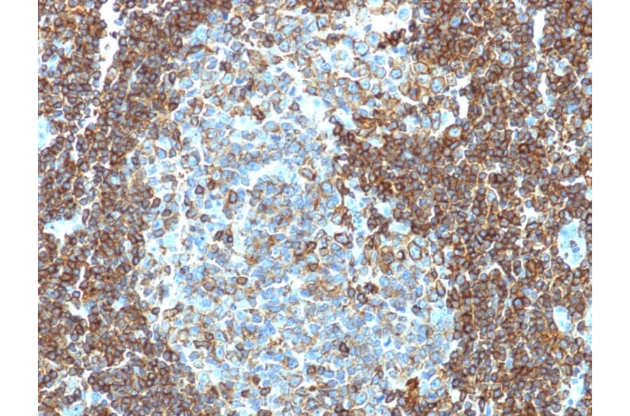 Immunohistochemistry - Anti-CD3 epsilon Antibody [PC3/188A] - BSA and Azide free (A253672) - Antibodies.com