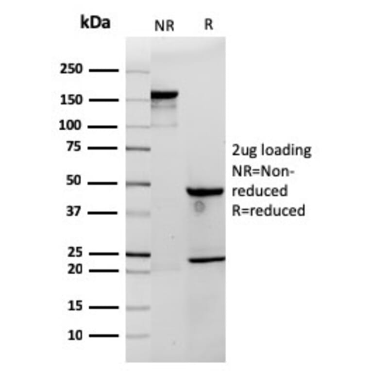 SDS-PAGE - Anti-CD3 epsilon Antibody [rC3e/1308] - BSA and Azide free (A253678) - Antibodies.com
