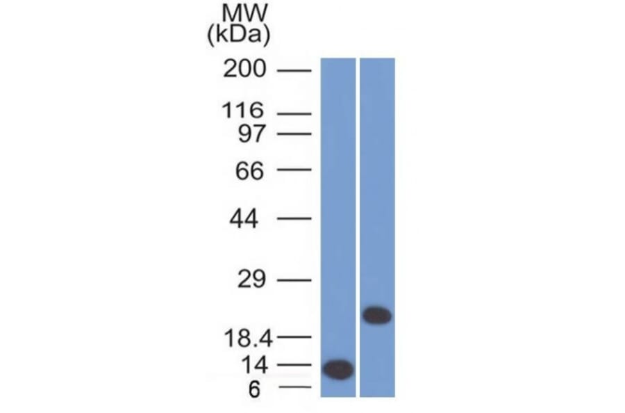 Western Blot - Anti-CD3 epsilon Antibody [C3e/1308] - BSA and Azide free (A253685) - Antibodies.com
