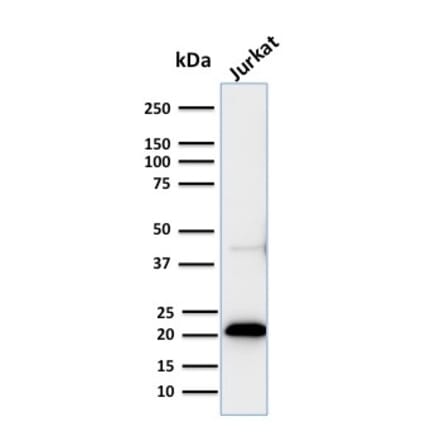 Western Blot - Anti-CD3 epsilon Antibody [C3e/2858R] - BSA and Azide free (A253686) - Antibodies.com